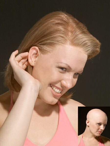 Women with Alopecia Totalis trying on undetectable vacuum wigs | Shop Vacuum Wigs www.feelmorelikeuhair.com