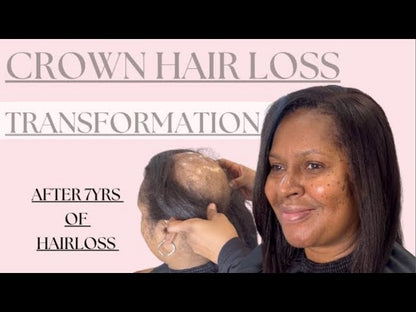 M.I.R.A.C.L.E. Hair Solution